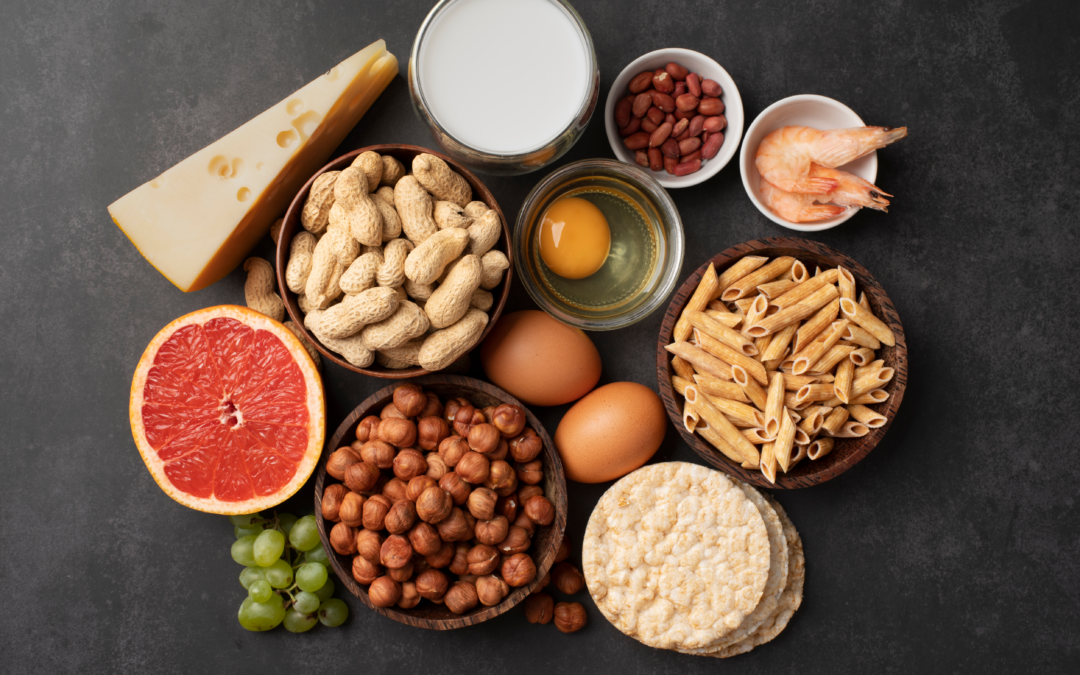 5 Tips from a Food Safety Consultant on Building an Effective Allergen Management Program